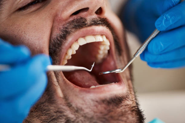 Best Emergency Denture Repair in Sweetser, IN